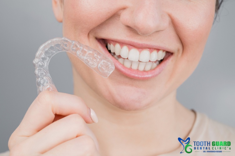 Fixed clear orthodontics